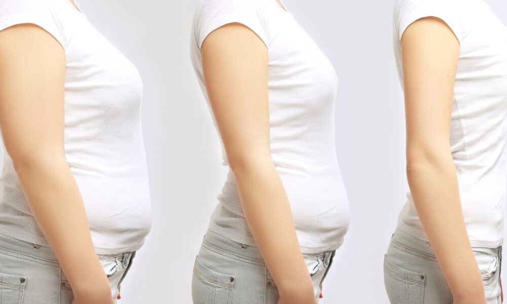 traveling-for-medical-weight-loss:-a-new-kind-of-health-journey